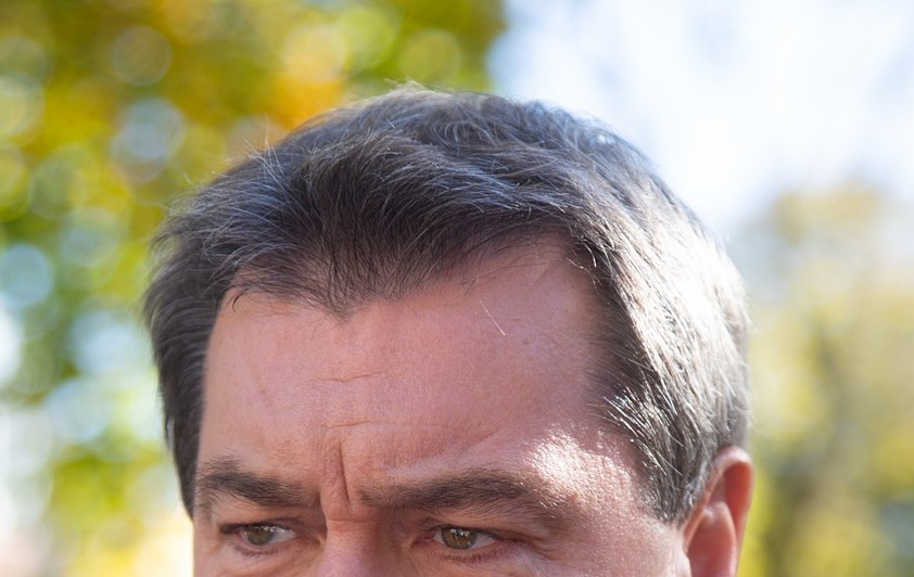 前頭骨 おでこ の加齢性変化と男女差